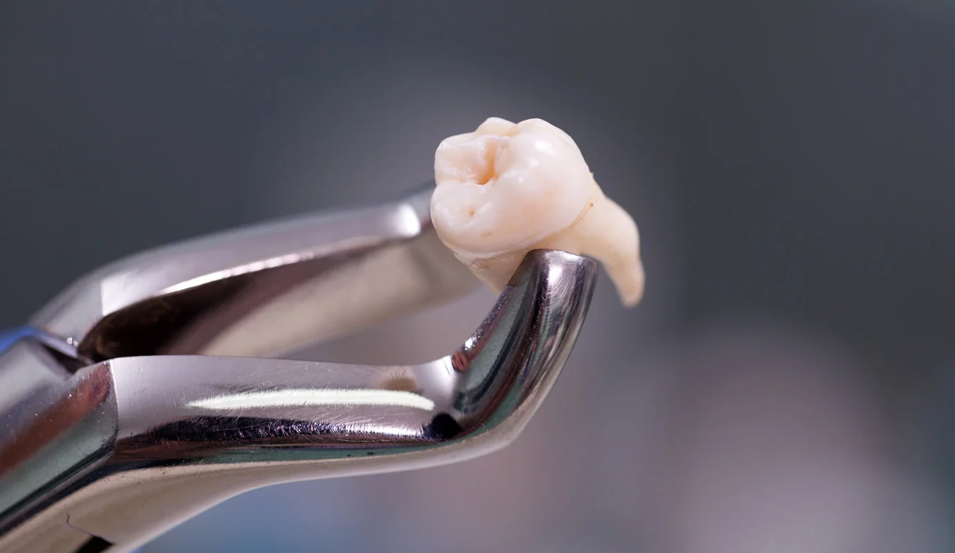 高輪／泉岳寺駅2分で「親知らずの抜歯／口腔外科」｜KISSEI DENTAL CARE